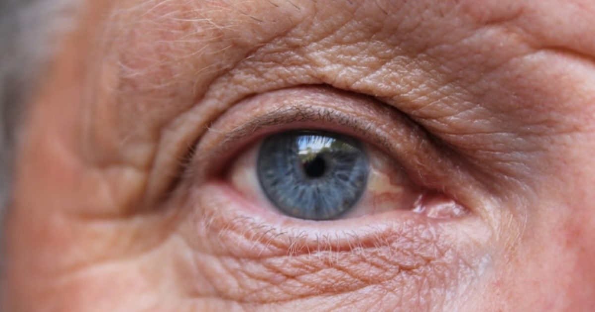 Aging Vision Age-related Macular Degeneration | Camas Center Clinic
